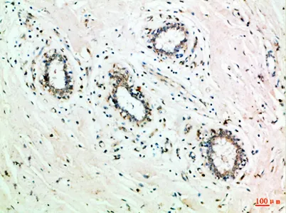 GRB7 rabbit pAb - image 1