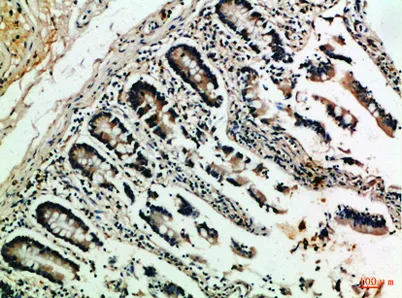 NFATc2 rabbit pAb - image 1