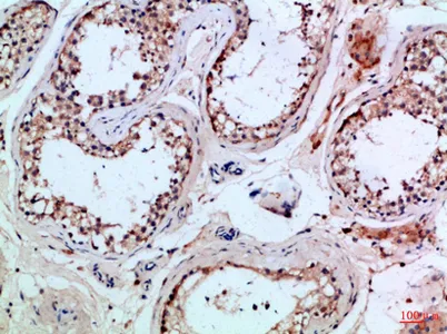 PI 3-Kinase p85β rabbit pAb - image 1