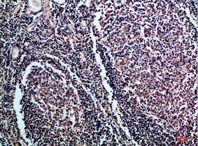 CD1A/B rabbit pAb - image 1