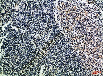 CD52 rabbit pAb - image 1