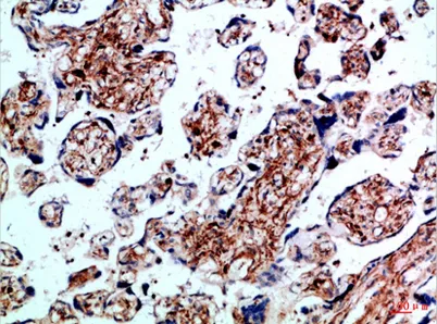 BMPR-IB rabbit pAb - image 1