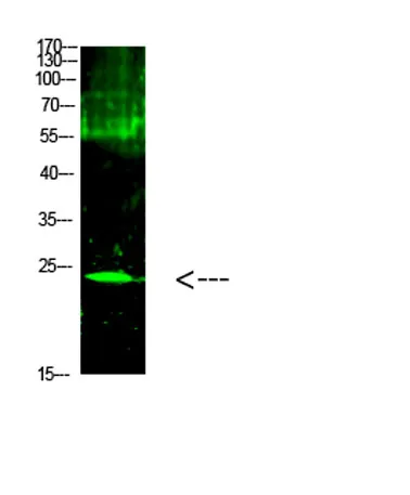 Cardiotrophin-1 rabbit pAb - image 1