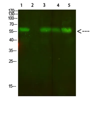 AVP Receptor V2 rabbit pAb