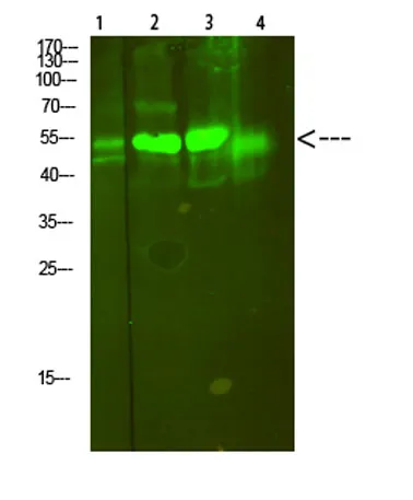 V-ATPase S1 rabbit pAb - image 1