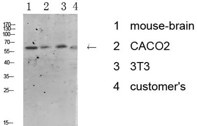 Tyrosine Hydroxylase rabbit pAb