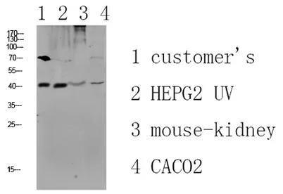 CCR5 rabbit pAb - image 1