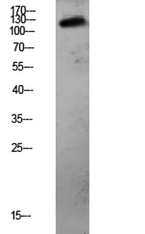 CDH3 rabbit pAb - image 1