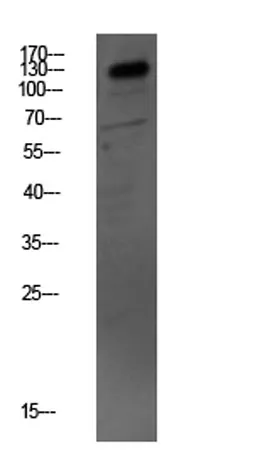 MYBPC3 rabbit pAb - image 1