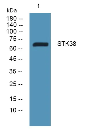 STK38 rabbit pAb - image 1