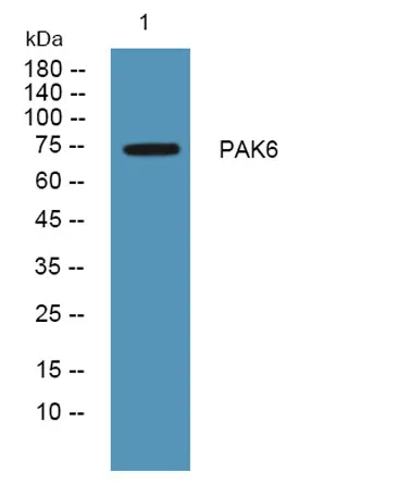 PAK6 rabbit pAb