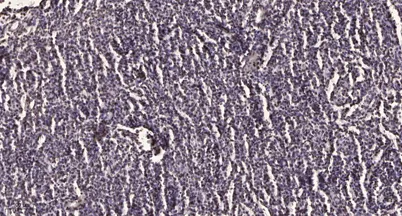 ARI1A rabbit pAb - image 1