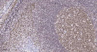 CHD6 rabbit pAb - image 1