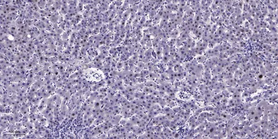CHD9 rabbit pAb