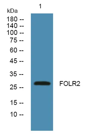 FOLR2 rabbit pAb - image 1