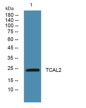 TCAL2 rabbit pAb