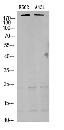 TRPM7 rabbit pAb - image 1