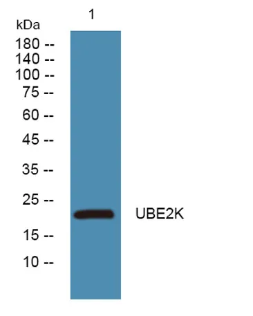 UBE2K rabbit pAb