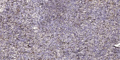ASPM rabbit pAb - image 1