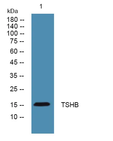 TSHB rabbit pAb - image 1
