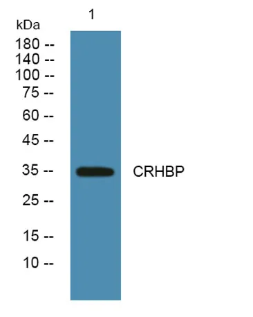 CRHBP rabbit pAb - image 1