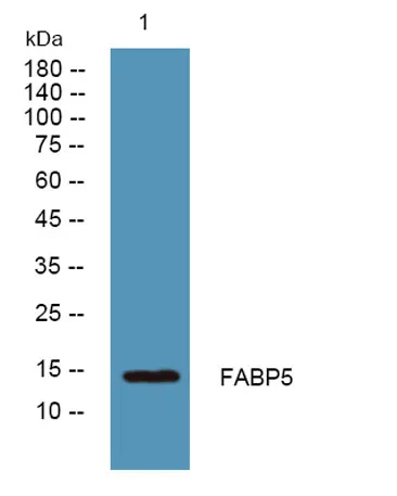 FABP5 rabbit pAb - image 1