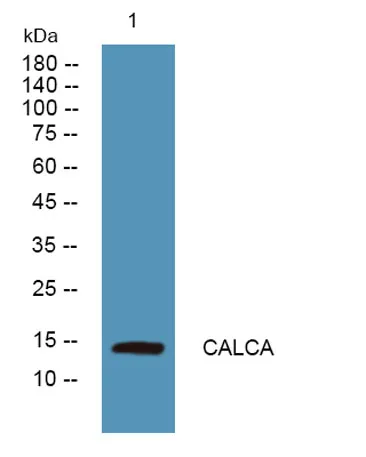 CALCA rabbit pAb - image 1
