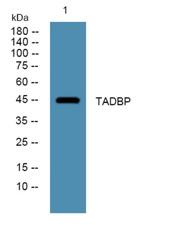 TADBP rabbit pAb