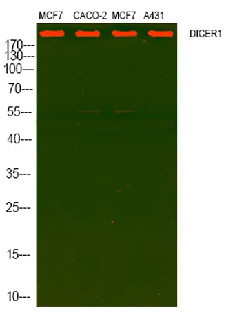 DICER rabbit pAb - image 1