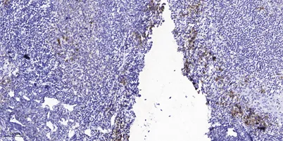 HER2 (Phospho-Tyr1139) rabbit pAb