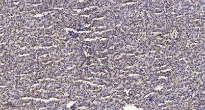 THRB (heavy chain, Cleaved-Ile364) rabbit pAb