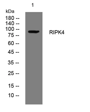 RIPK4 rabbit pAb - image 1