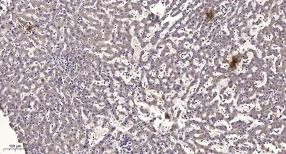 Kallikrein-14 (Cleaved-Ile25) rabbit pAb - image 1