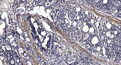 REPS1 (phospho-Ser709) rabbit pAb - image 1