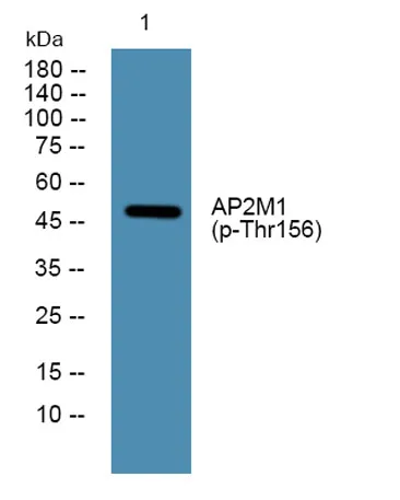 AP2M1 (phospho-Thr156) rabbit pAb - image 1