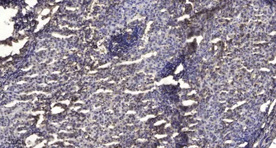 Stat1 (Acetyl Lys410/K413) rabbit pAb