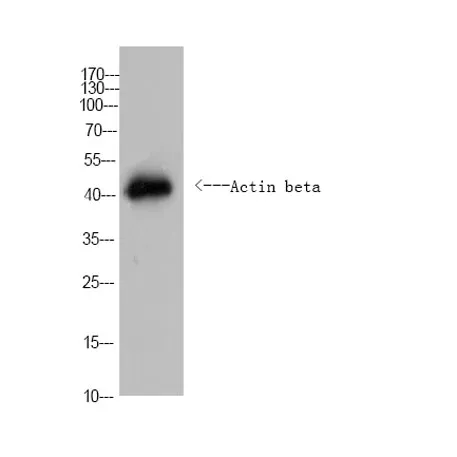 Actin beta Rabbit pAb (Caenorhabditis elegans)