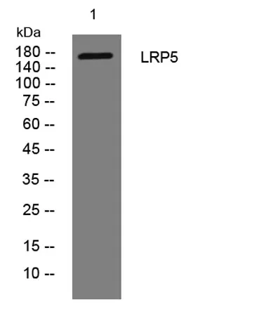 LRP5 rabbit pAb - image 1