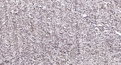 Ku-80 (Acetyl Lys565) rabbit pAb - image 1