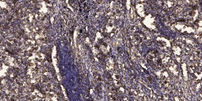 PSD95 (phospho-Ser295) rabbit pAb - image 1