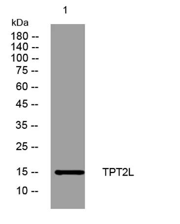 TPT2L rabbit pAb