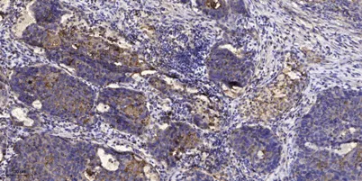 IRS-1 (phospho-Ser636/639) rabbit pAb - image 1
