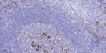 SREBP-1 (Acetyl-Lys324) rabbit pAb - image 1