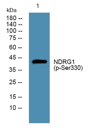NDRG1 (phospho-Ser330) rabbit pAb - image 1