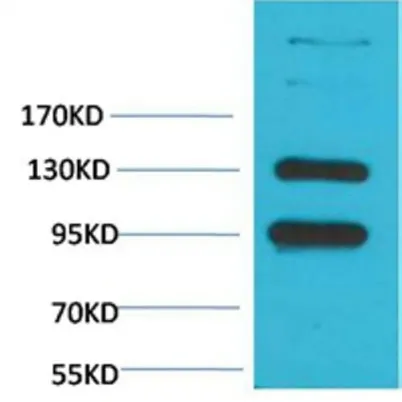 CaVα2δ1 rabbit pAb - image 1