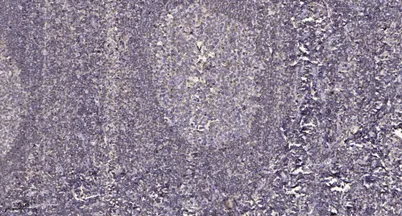 PNK1 (phospho-Ser114/Thr118) rabbit pAb - image 1
