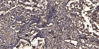 Stat2 (Acetyl Lys384) rabbit pAb - image 1
