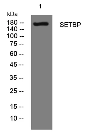 SETBP rabbit pAb