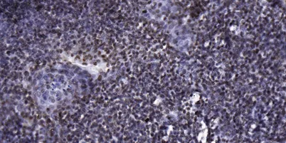 p70 S6 Kinase (phospho-Thr389) rabbit pAb - image 1