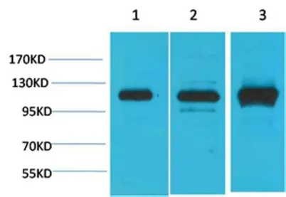 CaVα2δ2 rabbit pAb
